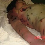 Woman in terrible condition in morgue