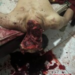 Almost decapitated with machete