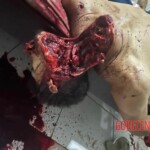 Almost decapitated with machete