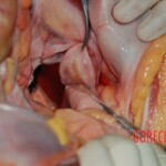 Autopsy of Chinese woman killed in car crash