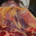 Autopsy of Chinese woman killed in car crash