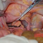 Autopsy of Chinese woman killed in car crash