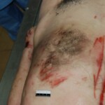 Autopsy of Chinese woman killed in car crash