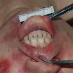 Autopsy of Chinese woman killed in car crash