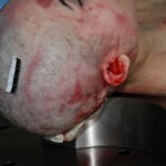 Autopsy of Chinese woman killed in car crash