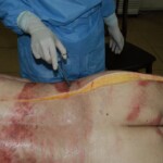 Autopsy of Chinese woman killed in car crash