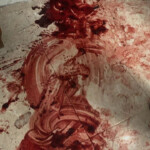 Bloody aftermath of Israeli anti-terrorist operation