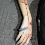 Female suicide jumper