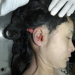 Chinese woman in morgue