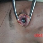 Drowned Chinese woman