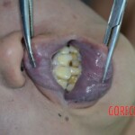 Drowned Chinese woman