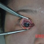 Drowned Chinese woman