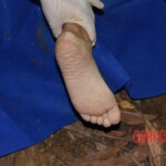 Examination of body of anally raped Chinese woman