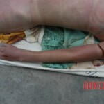 Examination of dead Chinese woman