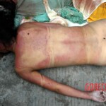 Examination of dead Chinese woman