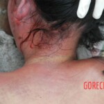 Examination of dead Chinese woman