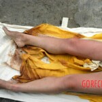 Examination of dead Chinese woman