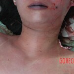 Examination of dead Chinese woman