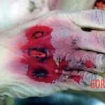 Hit, ran over and dragged under vehicle