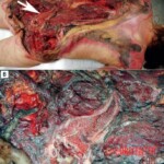 Hit, ran over and dragged under vehicle