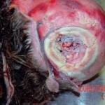 Hit, ran over and dragged under vehicle