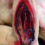 Hit, ran over and dragged under vehicle