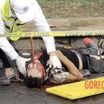 Man gets iron bar stuck in his head