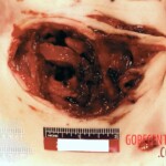 Murder of Angela Denise Crockett