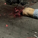 Gunshot literally blew her head off