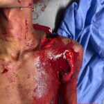 Neither of them won the machete fight