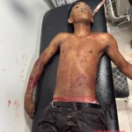 Neither of them won the machete fight