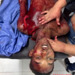 Neither of them won the machete fight