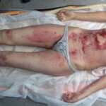 Young woman died in scooter accident