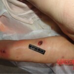 Young woman died in scooter accident