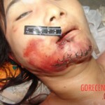 Young woman died in scooter accident