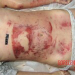 Young woman died in scooter accident