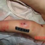 Young woman died in scooter accident