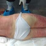 Young woman died in scooter accident