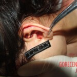 Young woman died in scooter accident