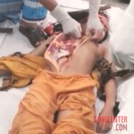 Autopsy of woman performed on street