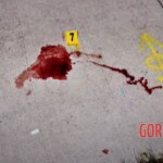 Chicago rapper Lil Jojo's gunshout wound