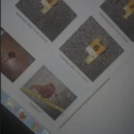 Chicago rapper Lil Jojo's gunshout wound