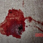 Chicago rapper Lil Jojo's gunshout wound