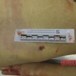 Chinese woman in morgue