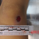 Chinese woman in morgue