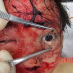 Chinese woman in morgue