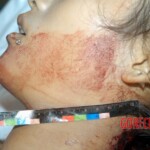 Examination and autopsy of stabbed Chinese woman
