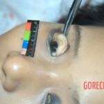 Examination and autopsy of stabbed Chinese woman