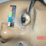 Examination and autopsy of stabbed Chinese woman