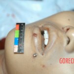 Examination and autopsy of stabbed Chinese woman